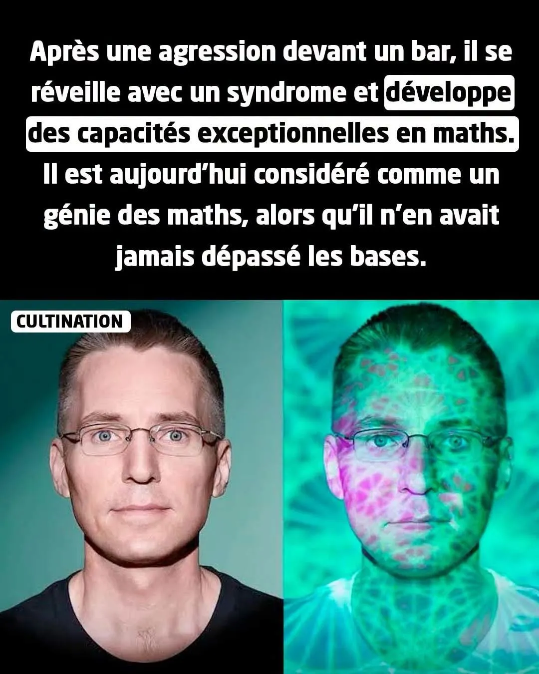 Illustration du post LinkedIn : Après un traumatisme crânien, il est devenu un génie des maths