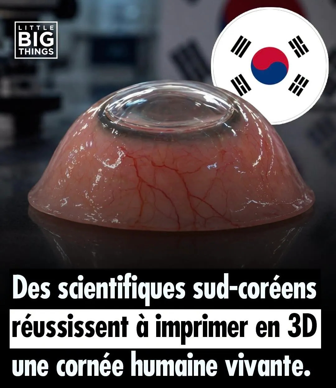 Illustration du post LinkedIn : Impression 3D d'une cornée en Corée du Sud