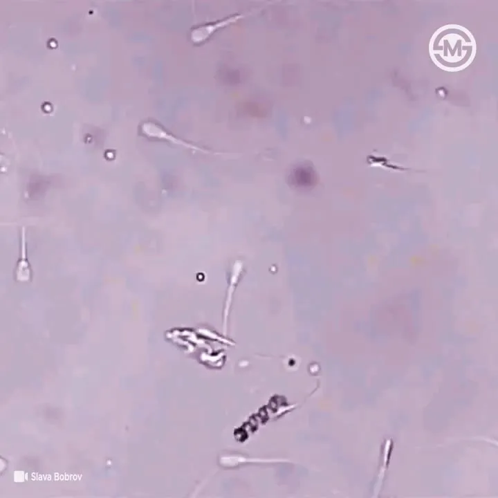 Image: Un nanorobot pour accompagner les spermatozoïdes jusqu'à l'ovule