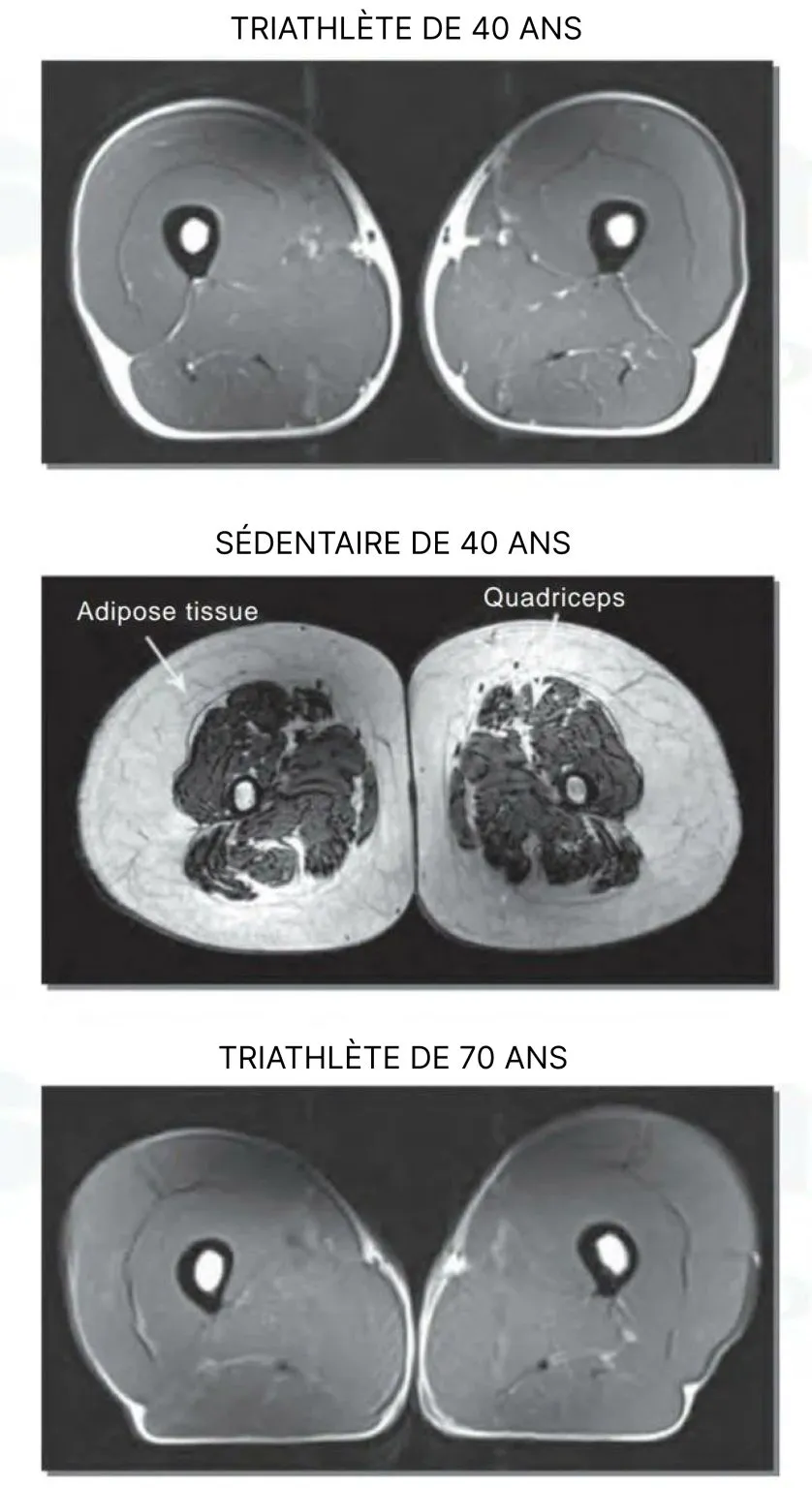 Image: Les vieux sportifs ont des meilleurs cuissots que les jeunes sédentaires