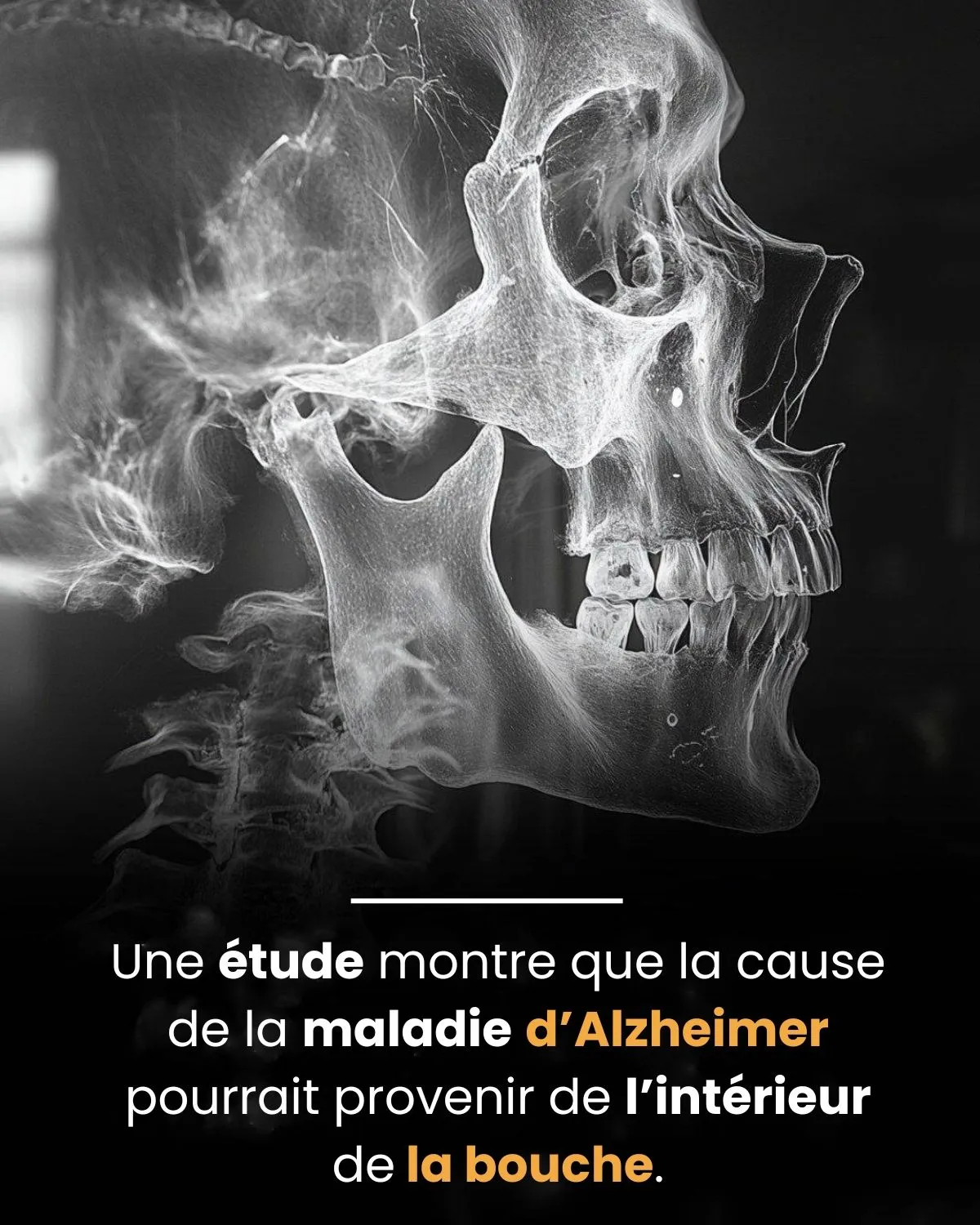 Image: Alzheimer et l’hygiène bucco-dentaire