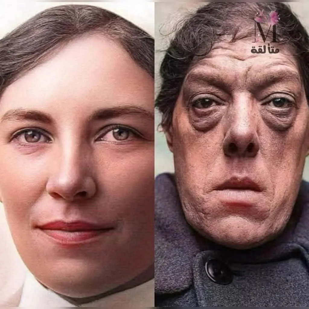 Image: L'histoire de Mary-Ann Bevan, la femme la plus laide du monde
