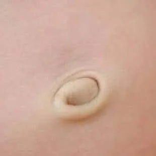 Image: Pourquoi mettre de l'huile sur le nombril ?