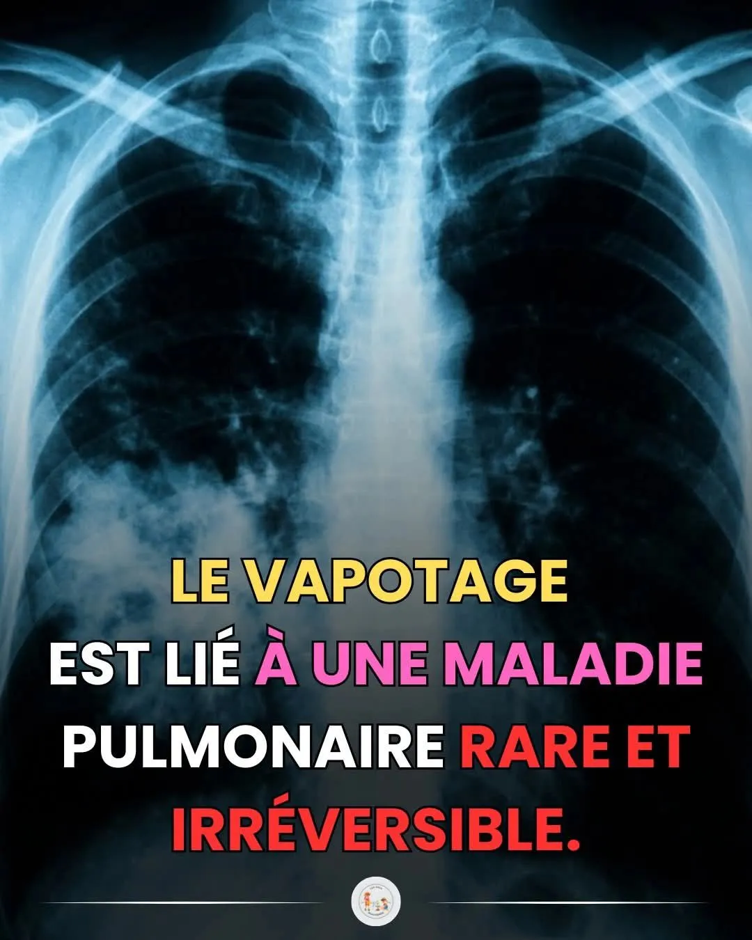 Image: Les cigarettes électroniques aromatisées sont dangereuses pour la santé