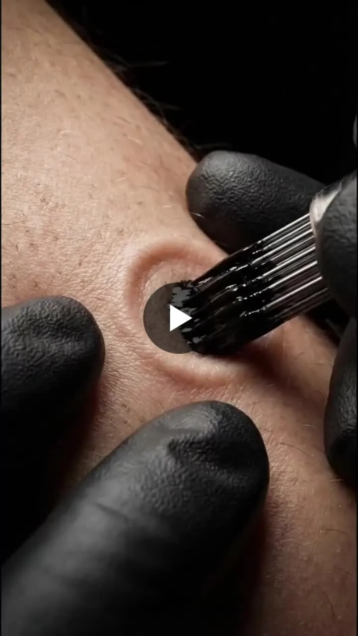 Image: Le tatouage est une guerre microscopique permanente