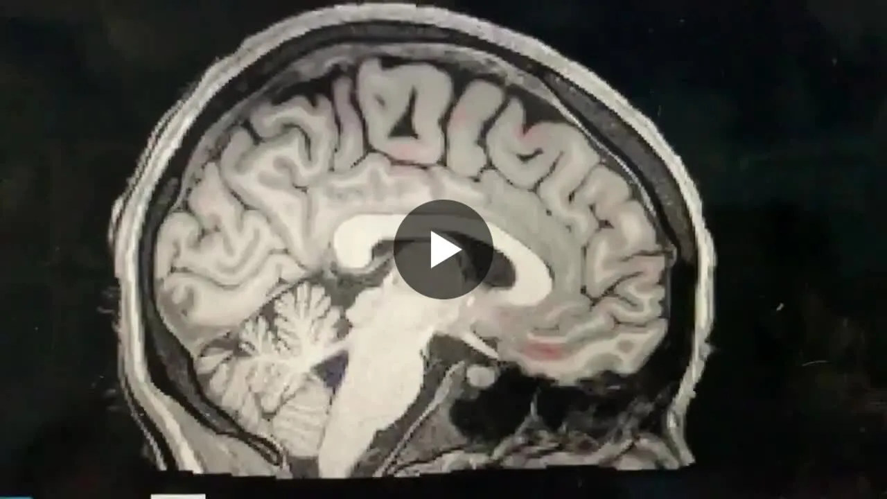 Image: Des scientifiques ont observé le lavage du cerveau pendant le sommeil